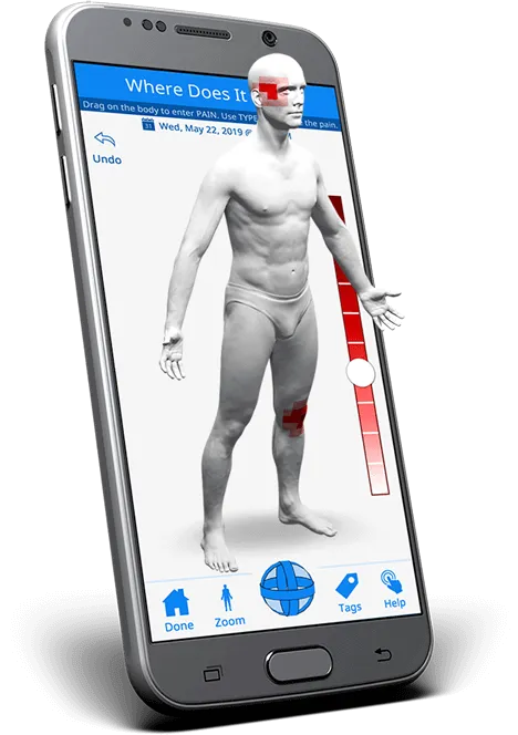PainTrek App